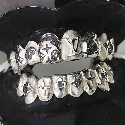 lv grillz